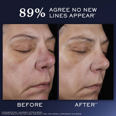 Génifique Ultimate Recovery Serum