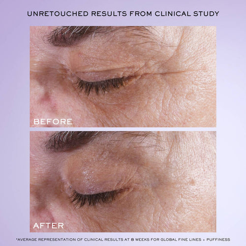 Rénergie H.C.F. Triple Serum Eye