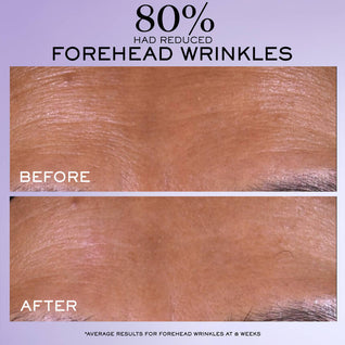 Rénergie C.R.x. Triple Serum Retinol
