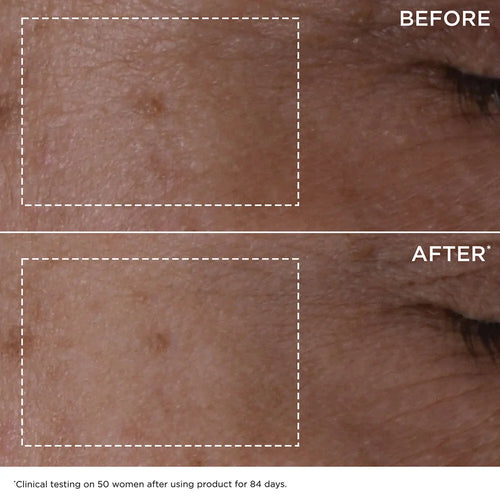 Anti-Aging + Anti-Wrinkle Serum