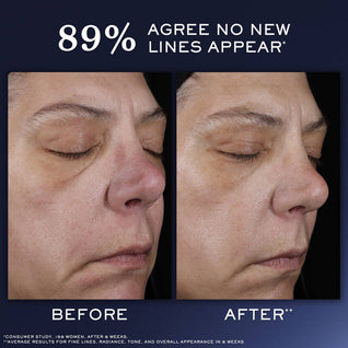 Génifique Ultimate Recovery Serum