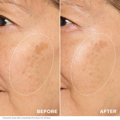 Bright Plus [Advanced] Serum