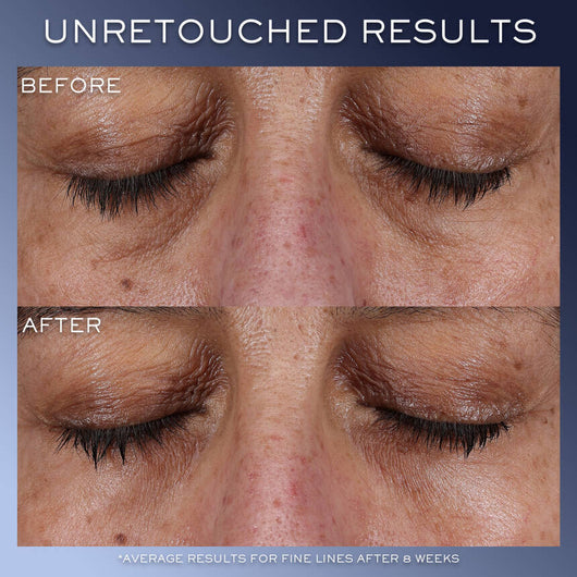 Génifique Ultimate Eye Cream