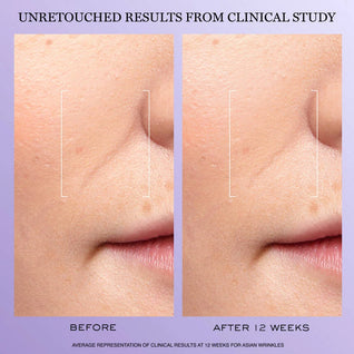 Rénergie H.C.F. Triple Serum