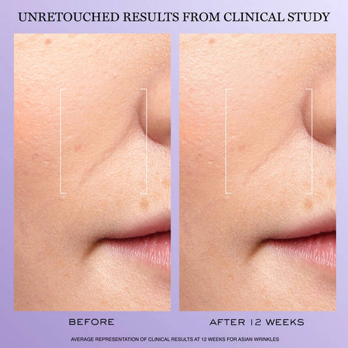 Rénergie H.C.F. Triple Serum