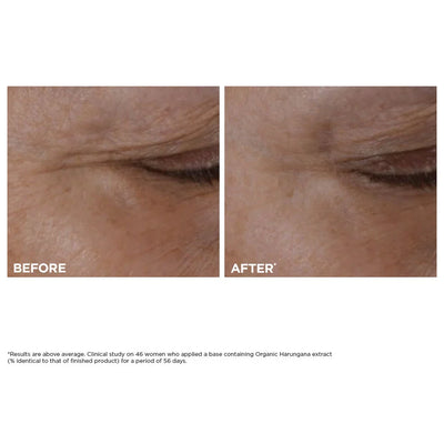 Total Eye Lift Refillable Eye Cream for Firming