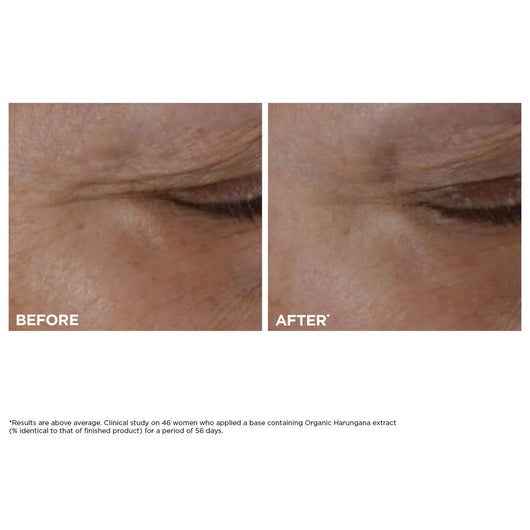 Total Eye Lift Refillable Eye Cream for Firming