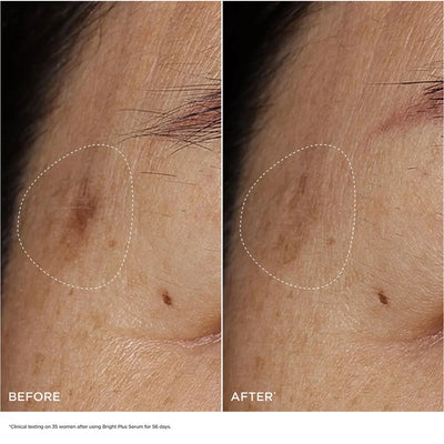 Bright Plus [Advanced] Serum