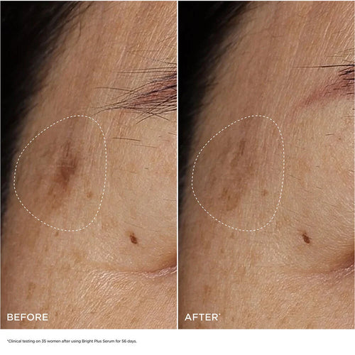 Bright Plus [Advanced] Serum