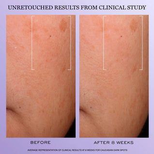 Rénergie H.C.F. Triple Serum