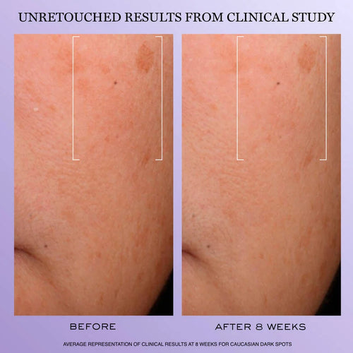 Rénergie H.C.F. Triple Serum