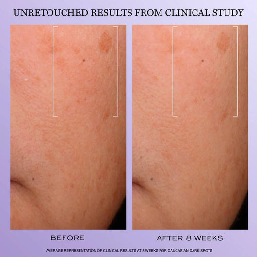 Rénergie H.C.F. Triple Serum