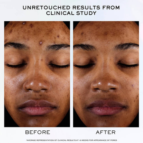 Clarifique Pro-Solution Serum